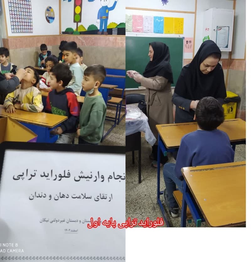 فلوراید تراپی